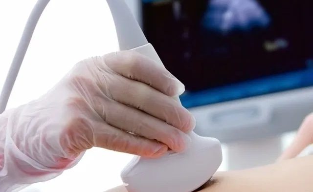 An ultrasound probe being used on a wrist